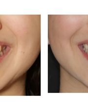 Aspen Ridge Dental image 7
