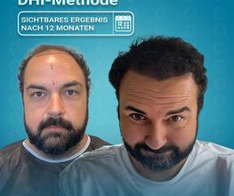 MedHair Clinic | Haartransplantationen in der Türkei Istanbul Bild 1