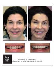 The Dental Design Center - Cosmetic, Implant & General Dentistry image 9