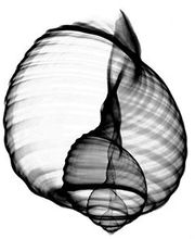 Centre d'Imagerie Médicale GIE Littoral Ouest image 2