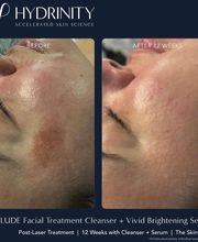 dermani MEDSPA Houston | Valley Ranch image 15