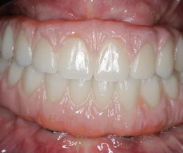 ModeLab Dental Bild 4