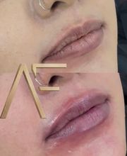 Dr Alexis Fernandez | Medicina Estetica imagen 1