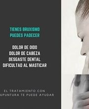 pm-acupuntura imagen 2