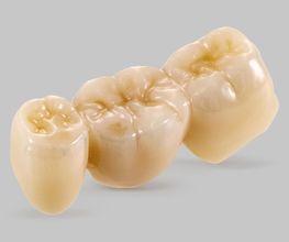 CeraLab - Das digitale Dentallabor Bild 7