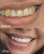 Barlow Family Dentistry image 12