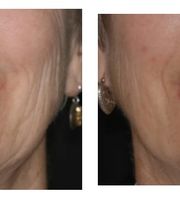 Aspen Ridge Dental image 18