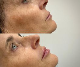 Juvenalia Brío | Botox, Hydrafacial & Ultraformer - Condesa / Roma Norte CDMX imagen 2