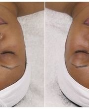 Schweiger Dermatology Group - Glen Carbon image 11