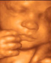 3D Foto Baby | Frauenarztpraxis Dr. med. Florian Hepp | München