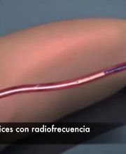 Clínica cardiovascular Dr. Valderrama imagen 1