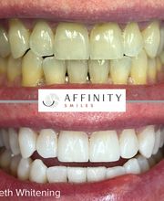 Affinity Smiles image 8