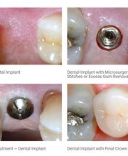 NYC Periodontics and Implant Dentistry: Scott O. Kissel, DMD, PC image 6