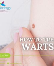 Affiliated Dermatology Tolleson image 18