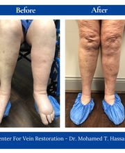 Center for Vein Restoration | Dr. Mohamed Hassan image 12