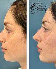 BeYouty Medical Spa image 15