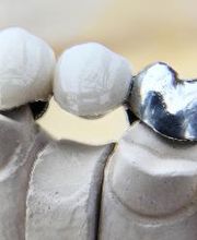 Family Dental Care image 7