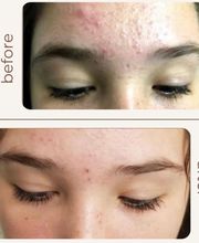 ALPINE SKIN CLINIC Bild 4