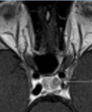 Prof. Dr. med. Merlo Adrian Bild 4