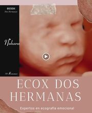 Ecox Dos Hermanas, Sevilla  Especialistas en ecografías 5D, 4D y 8K imagen 15