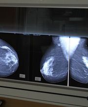 Cabinet de Radiologie de Pantin - IMPF image 2