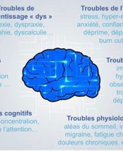 Neuromirror image 3
