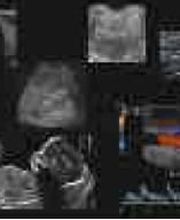 Chemla Patrick image 3