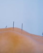 PHÖNIX TCM | Philipp Näf Bild 5