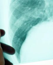 Dr. med. Walder Marcel Bild 6