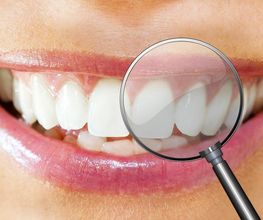 Zahnprothetik Vasi-Dental Bild 2
