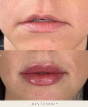 Skintonomy Medical Spa image 12