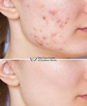 Schweiger Dermatology Group - Glen Carbon image 3