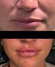 WildState Lawton image 14