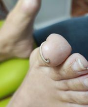 Podología clínica y deportiva Sureste imagen 2