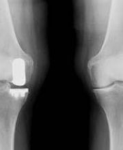 Orthopaedic Associates of Muskegon image 2