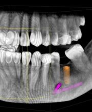 Dr. Stankovic | Feinste Zahnmedizin | Hannover Bild 5