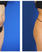 Ethos Plastic Surgery: Ginger Xu, M.D. image 11