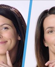 Schweiger Dermatology & Allergy - Millburn image 17