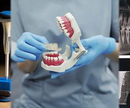 Azoy Dental SLP imagen 8