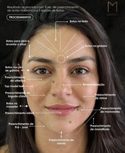 Instituto Marzola | Harmonização Facial imagen 18