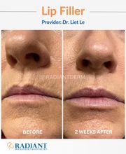 Radiant Dermatology & Aesthetics - Spring image 16