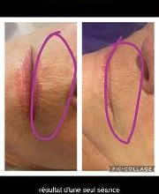 Dinastétique esthéticienne visagiste dermographe image 13