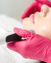 Microneedling