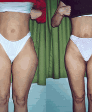 Medical Aesthetic Fettabsaugen Dr. Urs Benz Bild 2