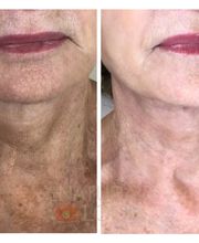 The Natural Look MedSpa image 6