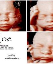 See Baby Ecografía Emocional imagen 8