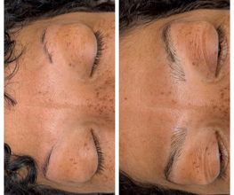 Augenbrauen Microblading - Skink Studio - Studio für Permanent Make-up in Köln