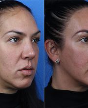 Gotham Plastic Surgery image 19