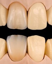 Palm Zahntechnik Inh. Sebastian Palm Bild 2