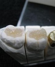 Atelier Zahntechnik / DentalLaborBaden Bild 1